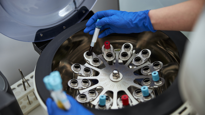 Clarifier and Centrifuge Monitoring